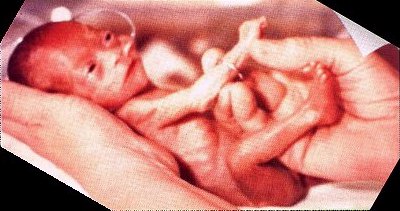 fetus_21_weeks_alive.jpg