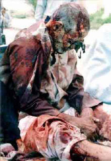 Photo of an old, gray-haired, gray-bearded man sitting on the ground, head bowed, hands clasped and resting on the ground, blood on parts of his head and blood soaking through his clothes on his right shoulder, arm, back, chest and legs. A bloody gash is visible on his right shin.