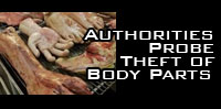 Authorities Probe Theft of Body Parts